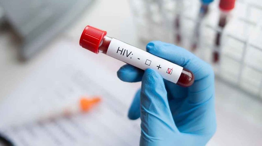 Türkiye’de vakıalar artıyor: Ahlâksızlık celladı insanları AIDS’in kucağına itiyor! 