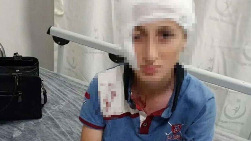 Köpek saldırısında yaralanan çocuğa 1,2 milyon liralık tazminat