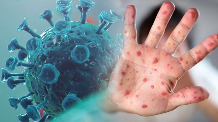 Avrupa'nın söz verdiği maymun çiçeği aşıları Afrika'ya ulaşmadı