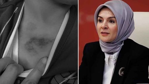 İBB kreşinde çocuğa işkence iddiası üzerine Bakan Göktaş’tan açıklama: Aileyi yalnız bırakmayacağız