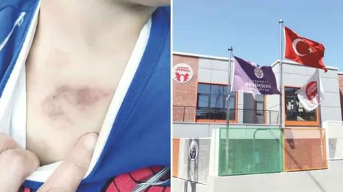 İstanbul Büyükşehir Belediyesi’ne bağlı Eyüpsultan’daki kreşte istismar