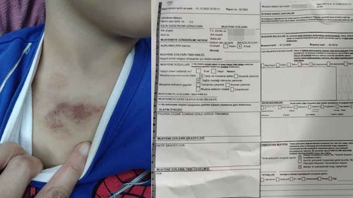 İBB kreşinde çocuğa darp ve istismar soruşturması: Bir kişi tutuklandı