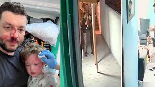 Yalova’da 14 aylık bebeğe saldırı davası: Skuter silah sayıldı, 36 yıl hapis talebi